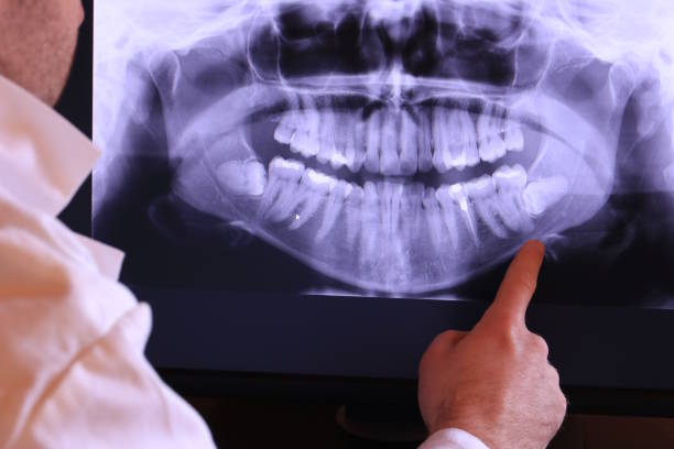 Best Dentist for Dental Trauma  in St Regis Park, KY
